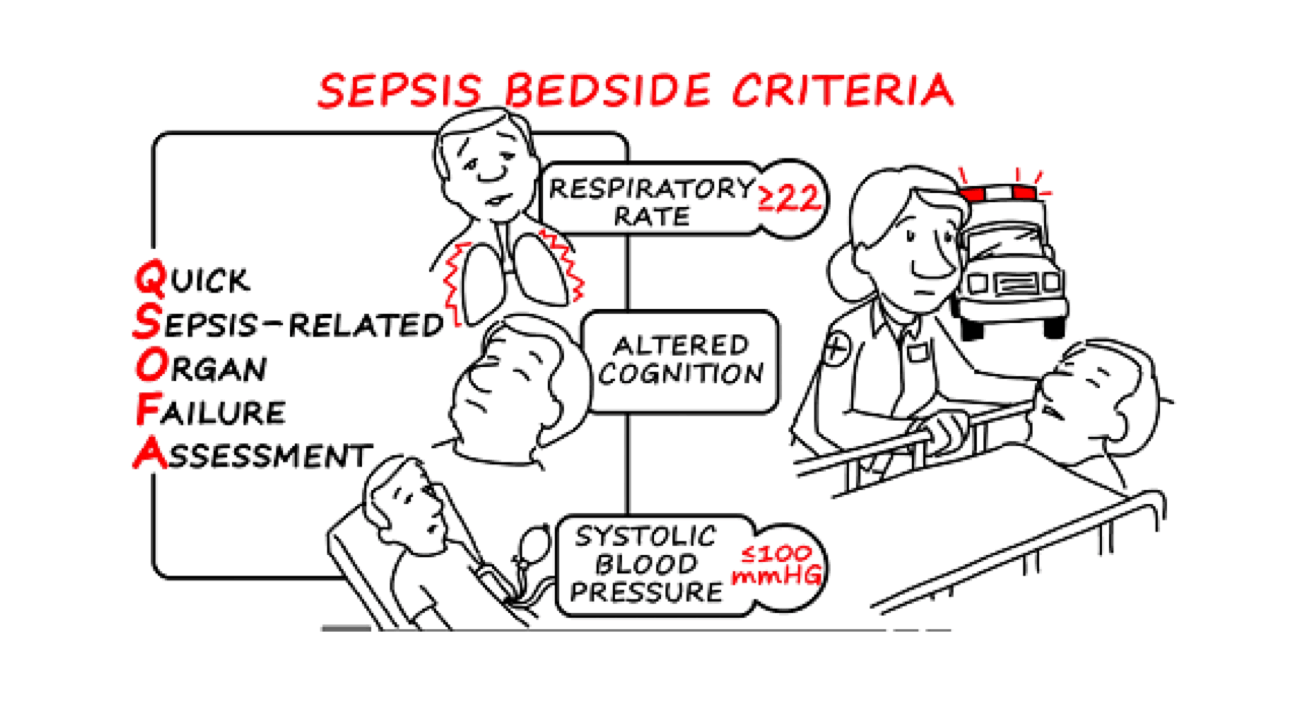 How To Quickly Identify Sepsis